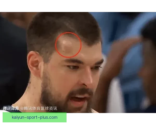 祖巴茨回应被打肿头不犯规称裁判判定克林根空接下次也要抡肘子